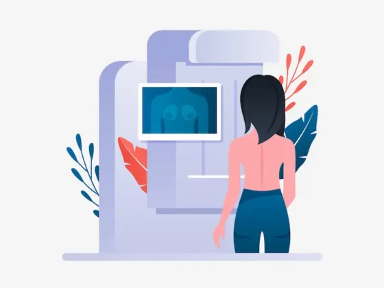 mammographie marseille