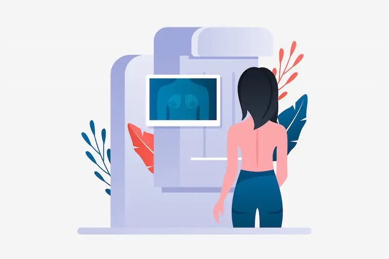 mammographie marseille