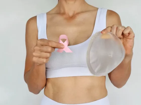 Mammographie et prothèses mammaires : comment ça se passe ?